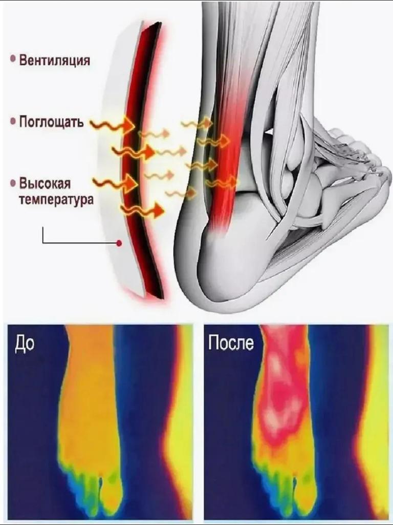 Plantární fasciitida bolest otok patní ostruha bolest náplast