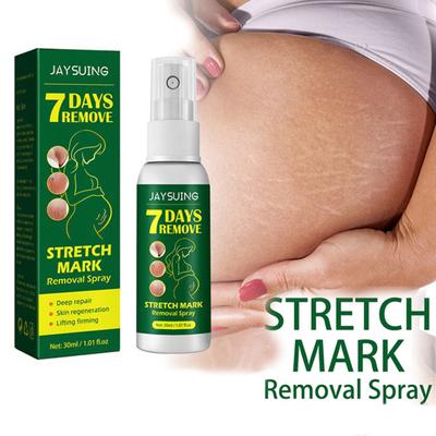 30ml Stretch Mark Spray Fast Absorption Moderate Effective Long Lasting Non-Pungent Repair Damage Gentle Stretch Mark Removal Spray for Home