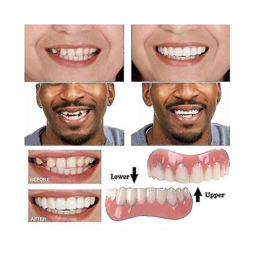 Extra Thin Fake Bright White Tooth Veneers Silicone Soft Safe Adhesive Denture Hide Shade Braces Comfortable Teeth Orthodontic