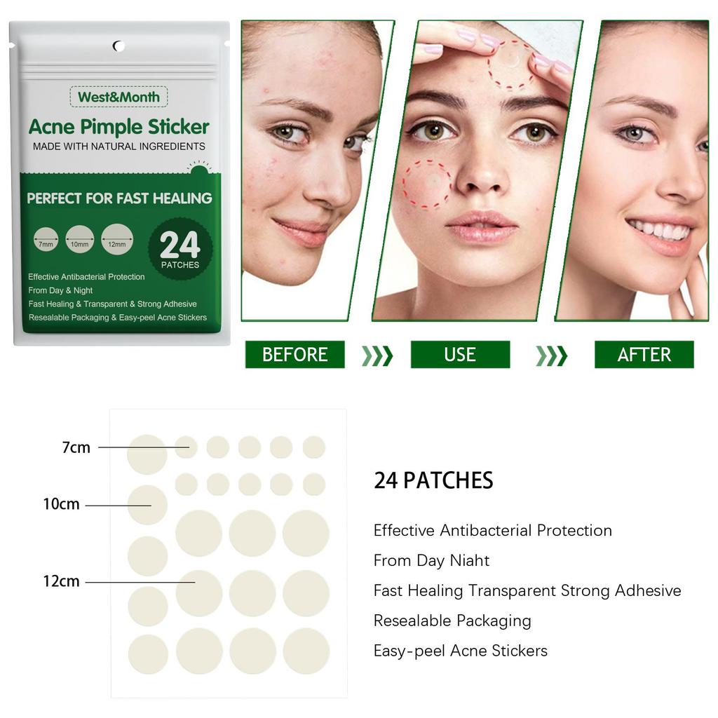West&Month Hydrocolloid Acne Patches, Invisible Acne Stickers, Pimple Removal Anti-Acne Hydrocolloid Patches, 36pcs