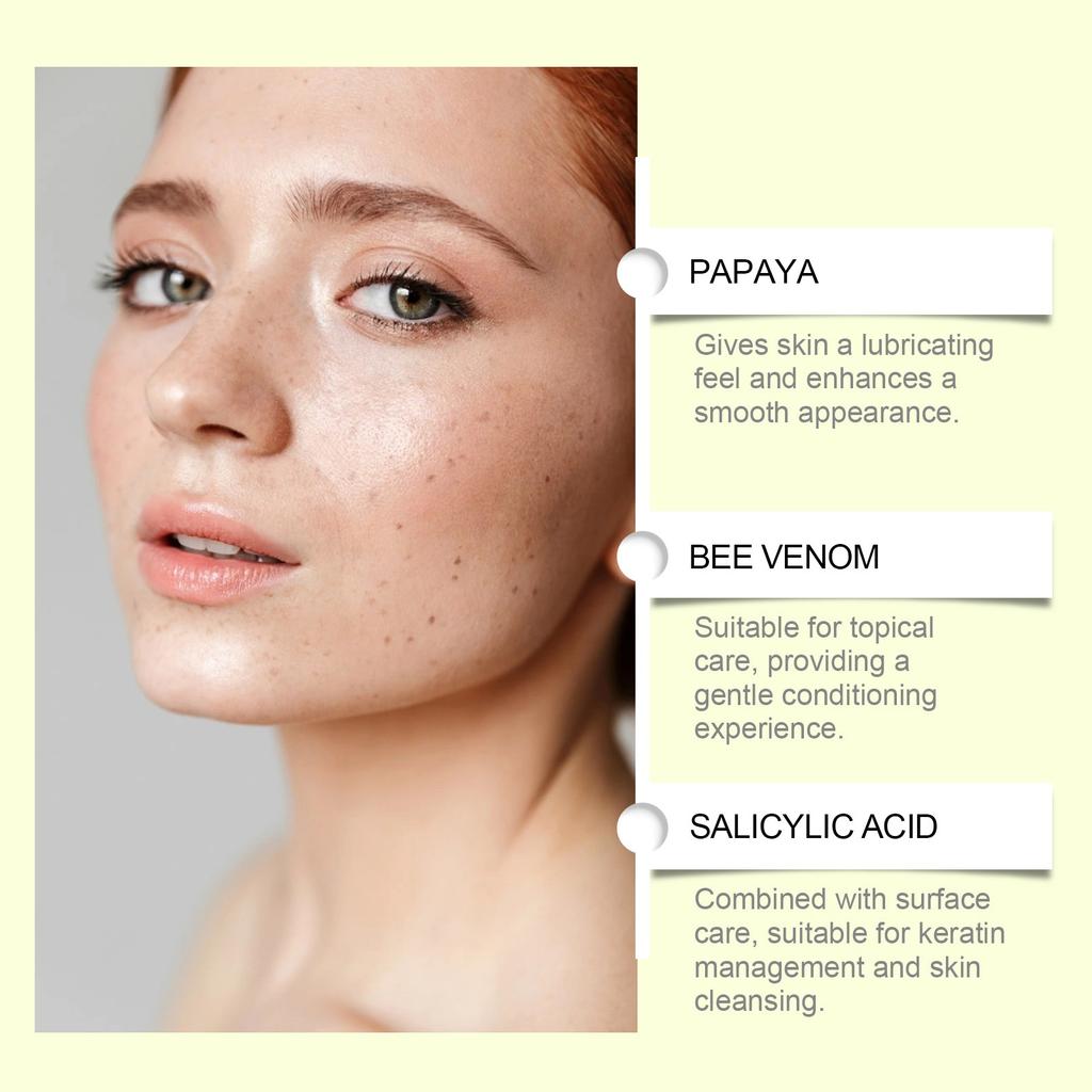 Dark Hyperpigmentation Remover For Face, Dark Hyperpigmentation Serum,Age,Brown,Acne ,Melasma Brown Dosing With For Women And Men 50g