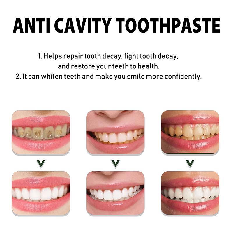 Blanchir les dents réparation dentifrice carie dentaire enlever la Plaque soulager la parodontite mal de dents élimination rafraîchit l'haleine soins des dents