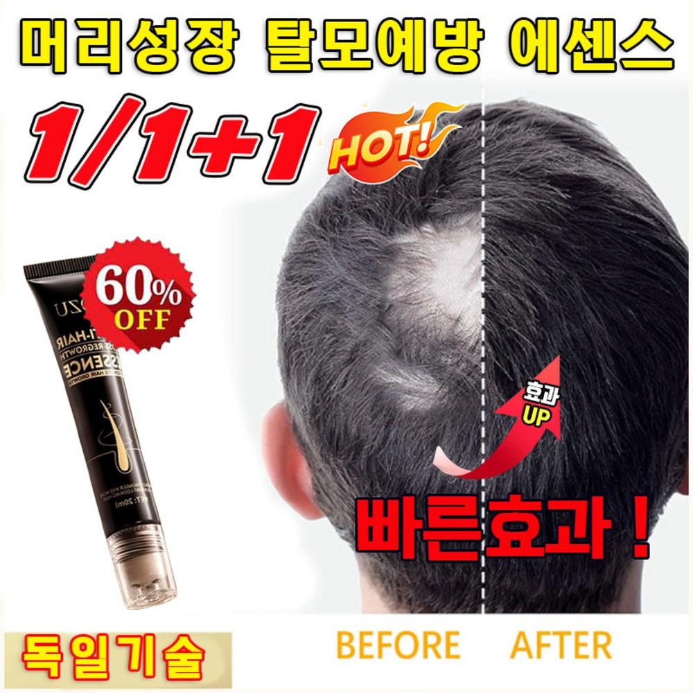 Hair Loss Ampoule Hair Growth Supplement M Specialized Hair Care Black Growth Enhancement Hair Care Scalp Essence, Scalp Nourishing Agent 4 pcs 20ml