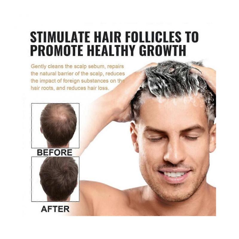 Spartan Shampoo Spartan Root Activator Shampoo Natürliche Haarwuchs Shampoos