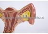 Female Pathology Uterus Model for Obstetrics & Gynecology Education