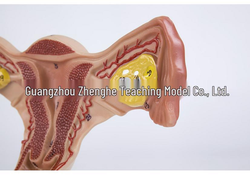 Female Pathology Uterus Model for Obstetrics & Gynecology Education