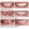 Smile Snap On False Teeth Upper Lower Dental Veneers Dentures Tooth Cover Set