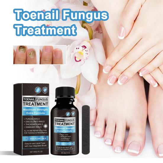 Extra starke Nagelpilz-Behandlung, natürliche Reparatur- und Erneuerungslösung mit 7 Ölen, einfache Anwendung, Lösung für gesunde Nägel, für Zehennägel und Fingernägel