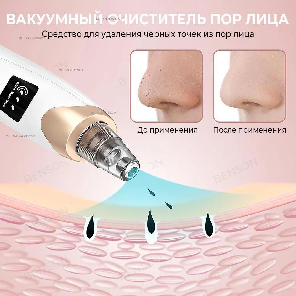 Vacuum washer tool to clear pores from black spots on the face. Cosmetic cleaner, using 5 kinds of fillers to clean face.