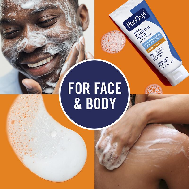 Acne Foaming Wash, For Face & Body, Maximum Strength, 1 oz (28 g)