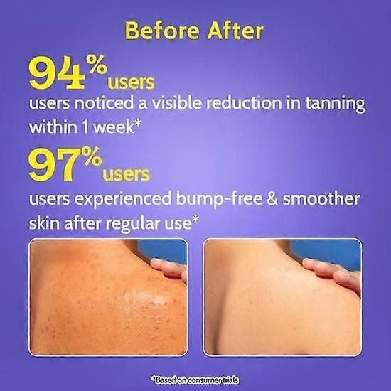 Chemist At Play 4% Salicylic Acid Exfoliating Body Wash 236ml | Enriched with Vitamin E  | Gentle Exfoliating Shower Gel |  Rough, Bumpy Skin