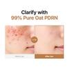 Purito Oat PDRN Gentle Refining Toner 200ml Hydrating Soothing Face Toner Gentle Exfoliating Skin Texture Korean Skincare