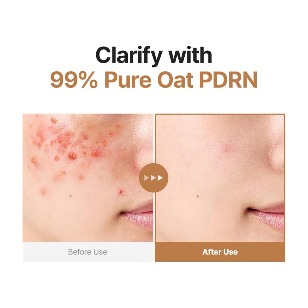 Purito Oat PDRN Gentle Refining Toner 200ml Hydrating Soothing Face Toner Gentle Exfoliating Skin Texture Korean Skincare