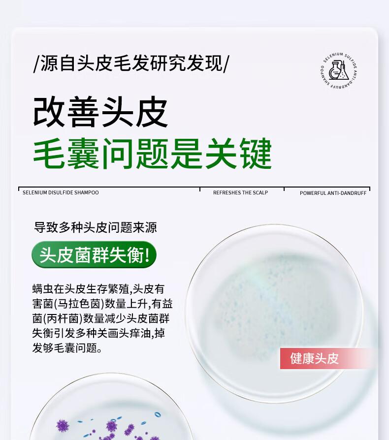 Beijing Tongrentang Selenium Disulfide dandruff shampoo, oil control, fluffiness, anti itch shampoo cream, dandruff shampoo