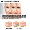 Ouhoe Kollagen Anti-Aging Essenz zur Reduzierung feiner Linien und Nasolabialfalten im Gesicht, Feuchtigkeitsspendende und Anti-Falten Essenz