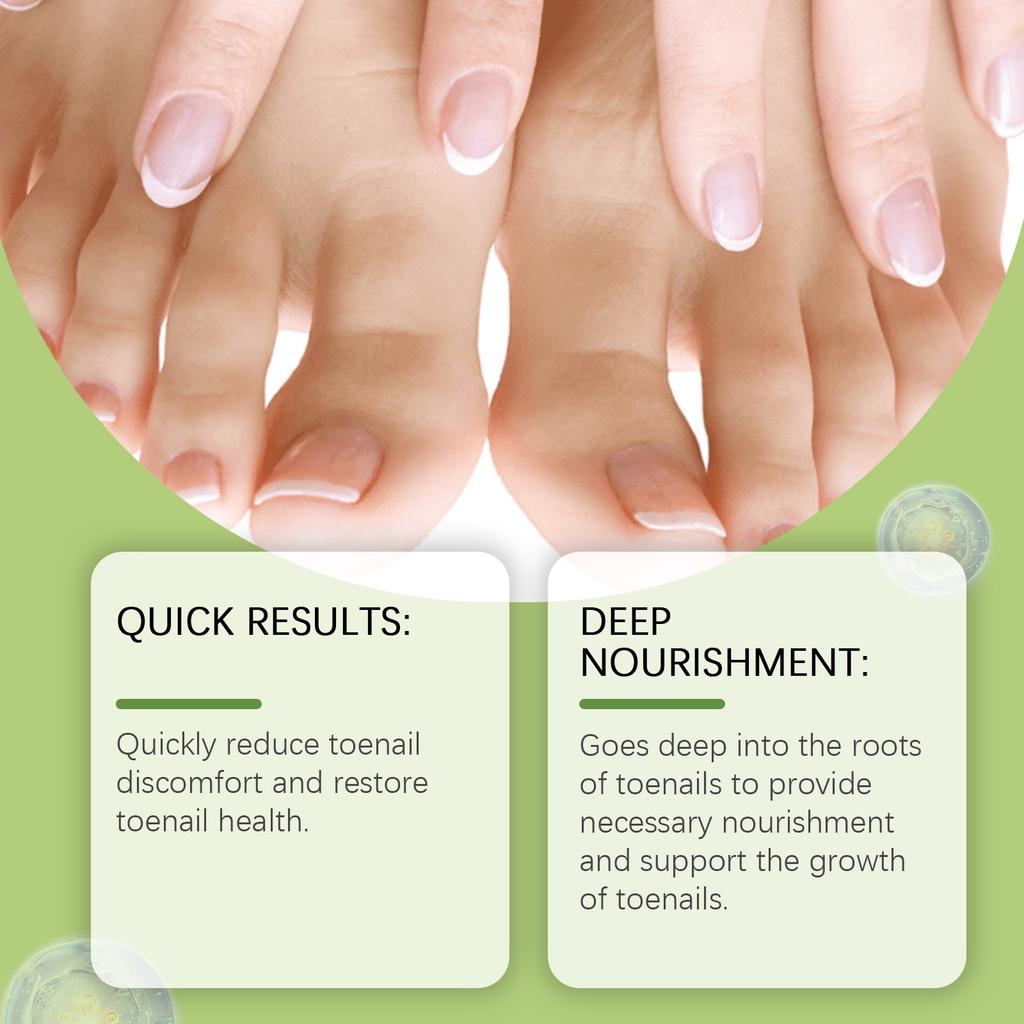 Toenail Fungus TreatmentExtra Strong  NailTreatment  Nail Care TreatmentExtra Strong For Thick  Discolored And Damaged Nails 30ml