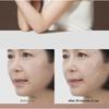 MARSHIQUE - Line Lifting Hydrogel Smile Line Patch