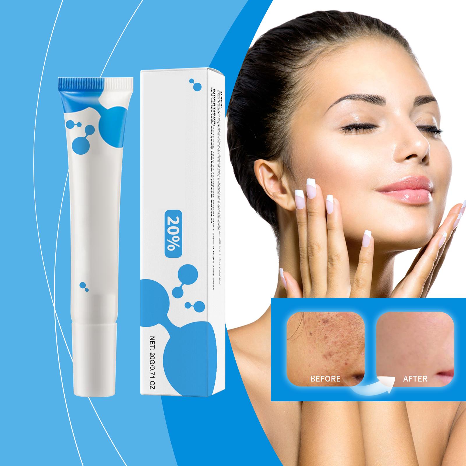 

Azelaic Anti-acne Cream Soothes Acne, Purifies And Moisturizes The Skin, Improves Skin Texture, And Acne Cream One Size