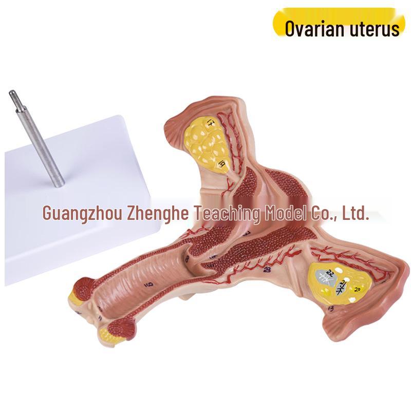 Female Pathology Uterus Model for Obstetrics & Gynecology Education