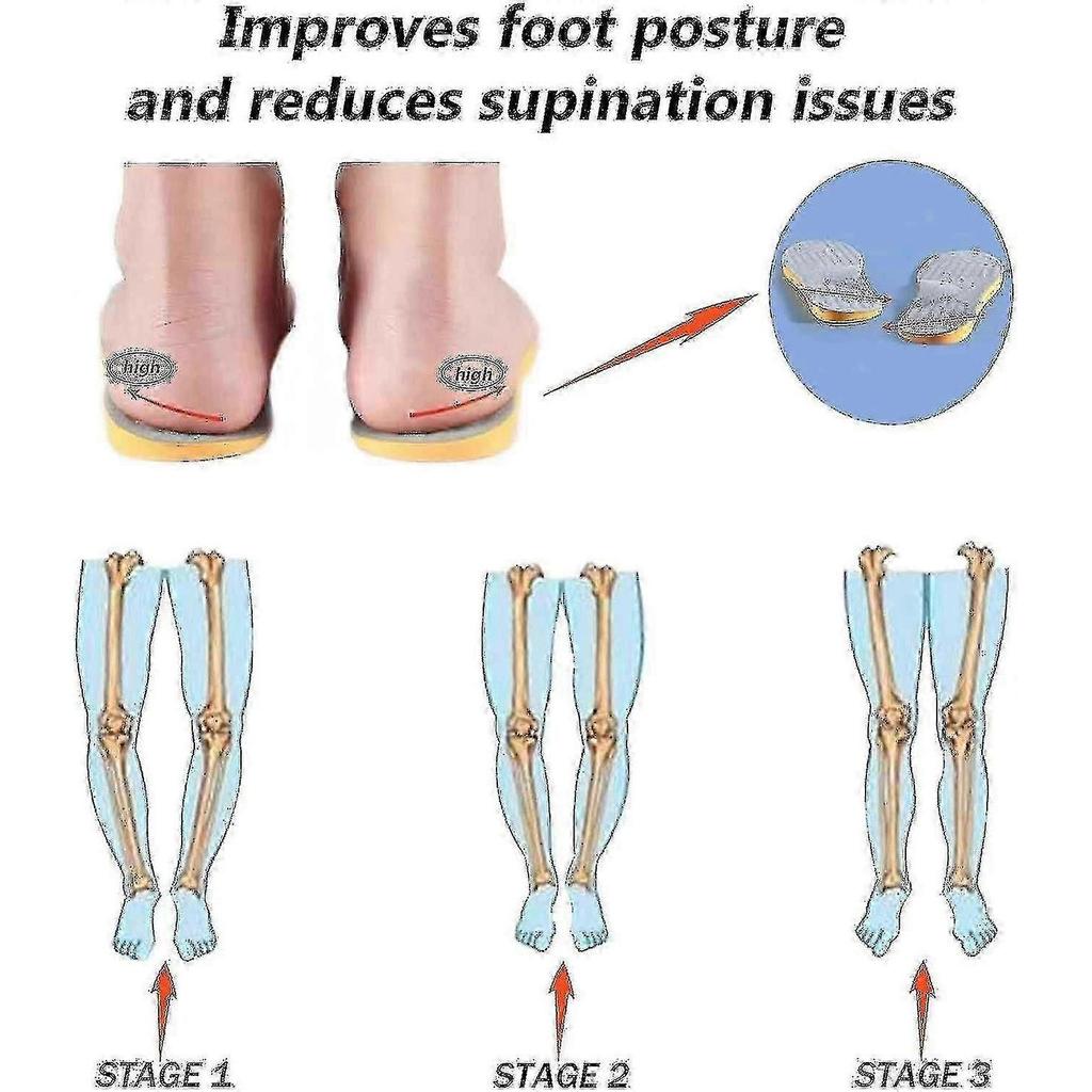 Supination Insoles For Over Supination High Arch Support, Orthotic Inserts For Men Women, Corrective Foot Supports For Supination Relief