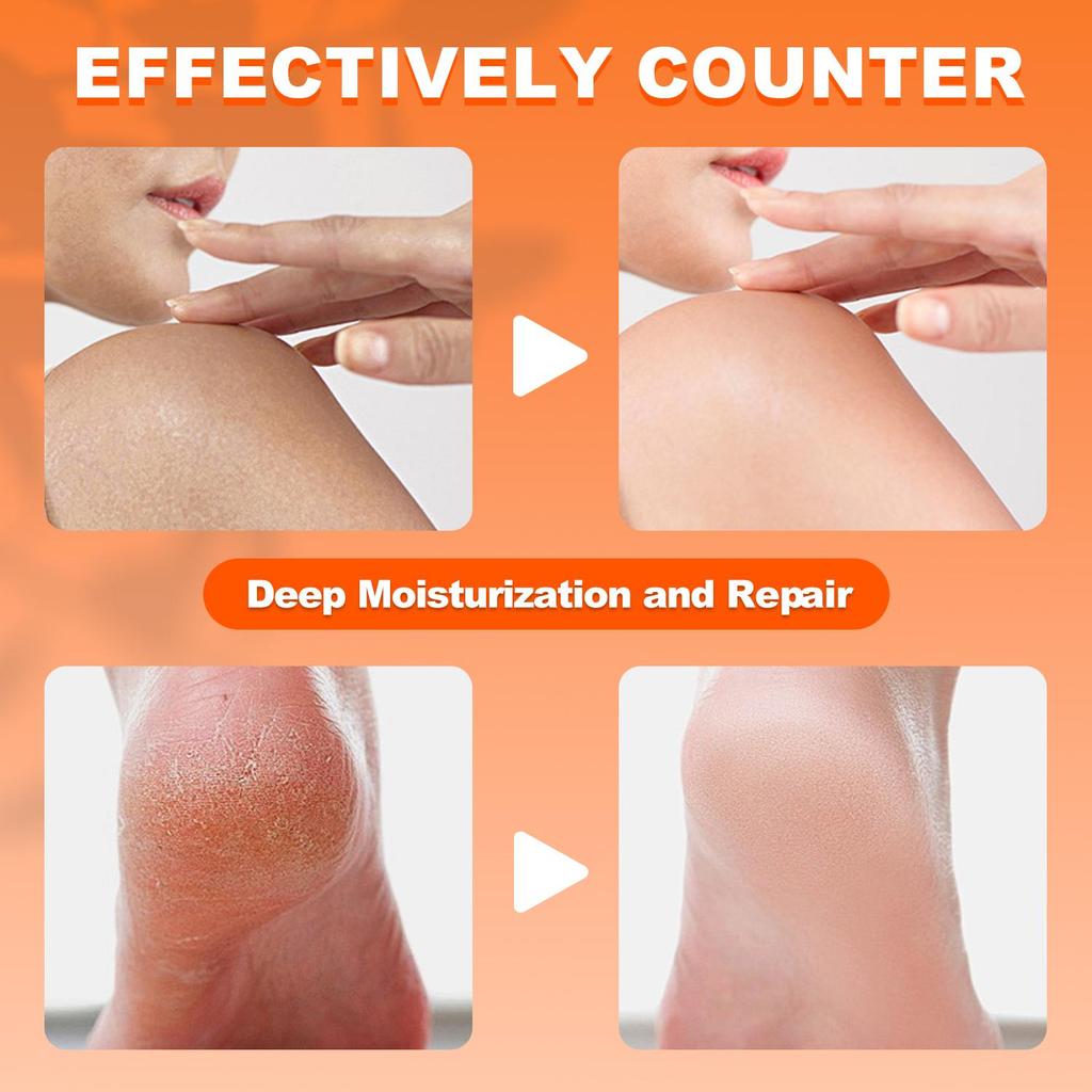 Crema all'Urea al 60%, Idrata Efficacemente Mani e Piedi Screpolati, Con Vitamina E, Aloe Vera e Burro di Karité, Assorbimento Rapido-100G