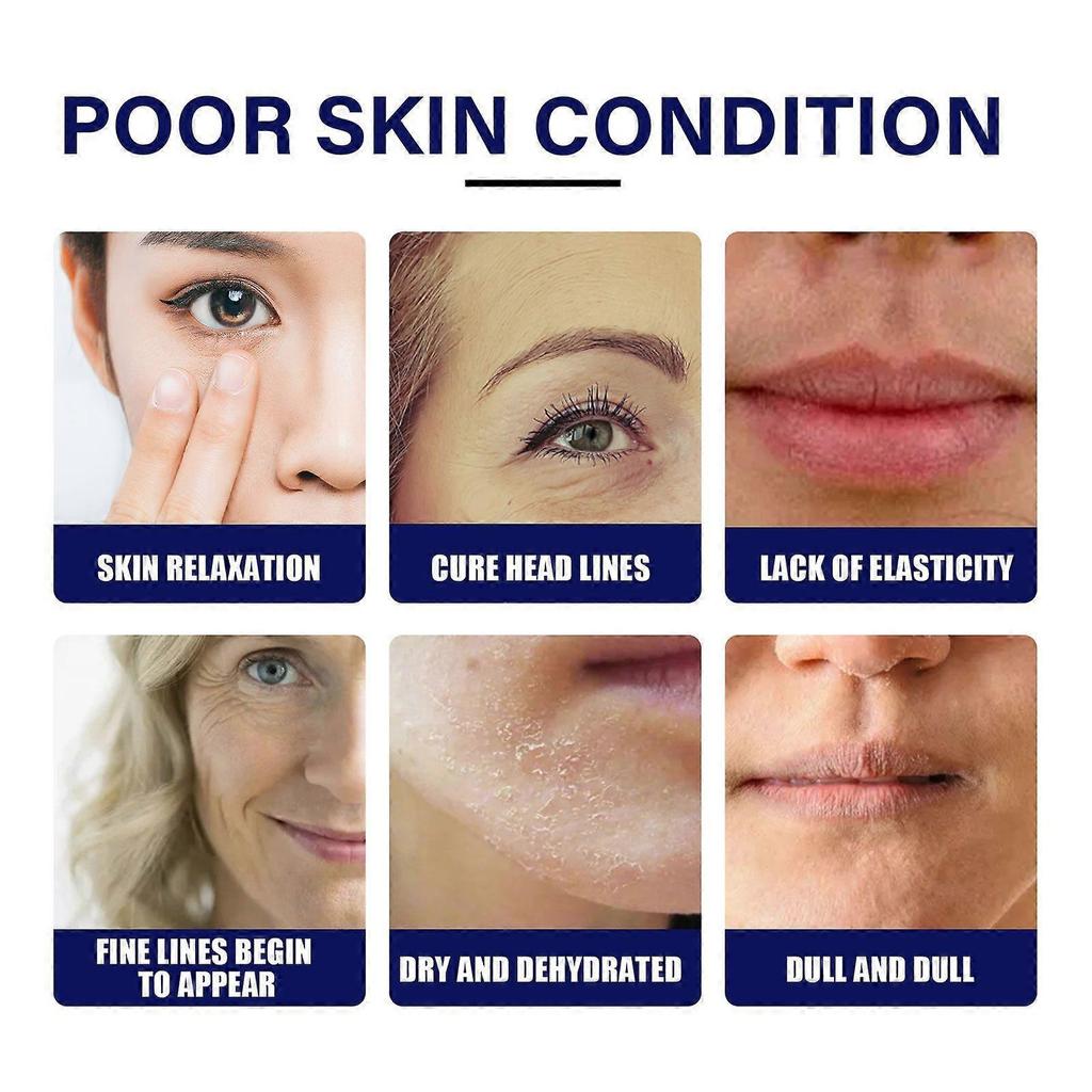 Limited time!!Hoygi Vitamin C Serum - Firming And Anti-Wrinkle Essence, Reduces Fine Lines, Brightens Skin, Hydrating And Moisturizing Serum