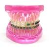 Dental Orthodontic Teeth Tooth Model 4 Kinds Brackets Ceramic and Metal Brackets for Patient Communication Dental Study Model