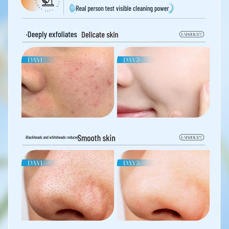 FIVERAMS Exfoliating Facial Cleansing Gel