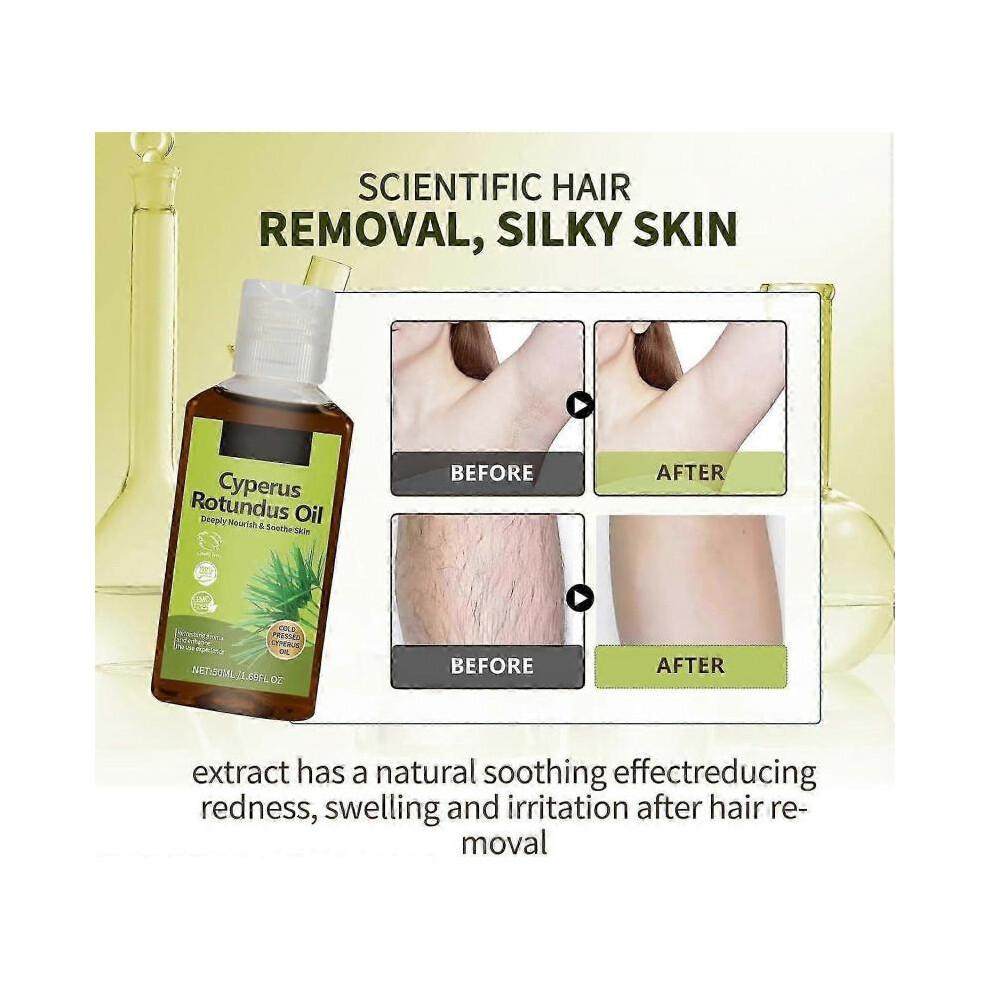 (2pcs)Cyperus Rotundus Oil, Natural Nut Grass Oil, Topical Cyperus Rotundus Oil for Hair Removal, Natural Cyperus Oil Reducing Body Hair Growth