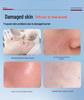Sodium Hyaluronate Patch: Class II Medical Device for Sensitive Skin, Hydration, Moisturization, Cold Compress, and Postoperative Repair