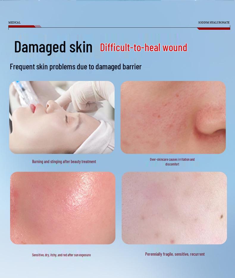 Sodium Hyaluronate Patch: Class II Medical Device for Sensitive Skin, Hydration, Moisturization, Cold Compress, and Postoperative Repair