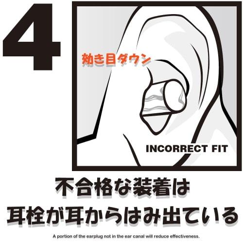 5-Pair Moldex Trial Earplugs (5 Types, Case Included): Meteor, Meteor Small, Purafit, Camo Plug, and Spark Plug (MisakaZoo Original Set)