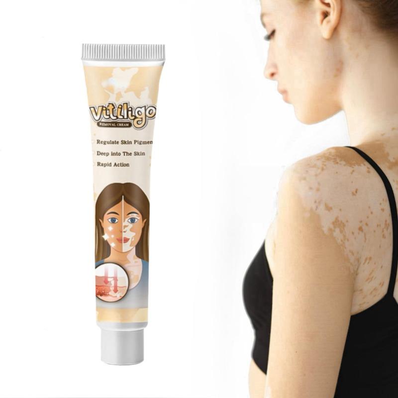 Behandlungscreme, antibakterielle Mittel, Psoriasis, lokalisierte Salbe, Mykose, Leukoplakie, Pflaster, Creme gegen weiße Flecken