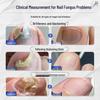 Nail Fungus Repair Solution