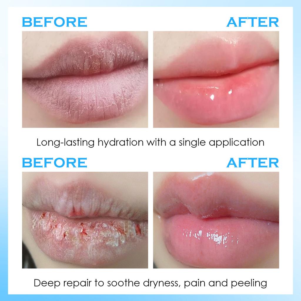Lip Serum Moisturizing Lip Balm Hydrating Repair Dry Lips Anti Wrinkle KissBeauty