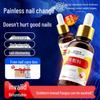 Beijing Tongrentang Fungal Nail Care Kit
