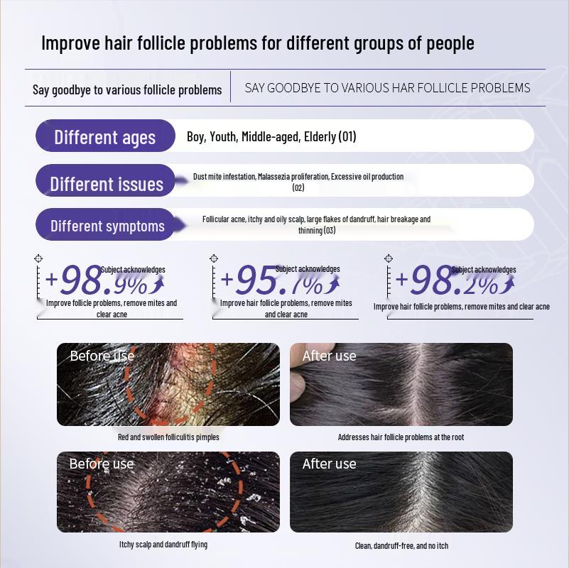 CVKK Medical Collagen Anti-Dandruff & Itch Relief Shampoo for Seborrheic Dermatitis.