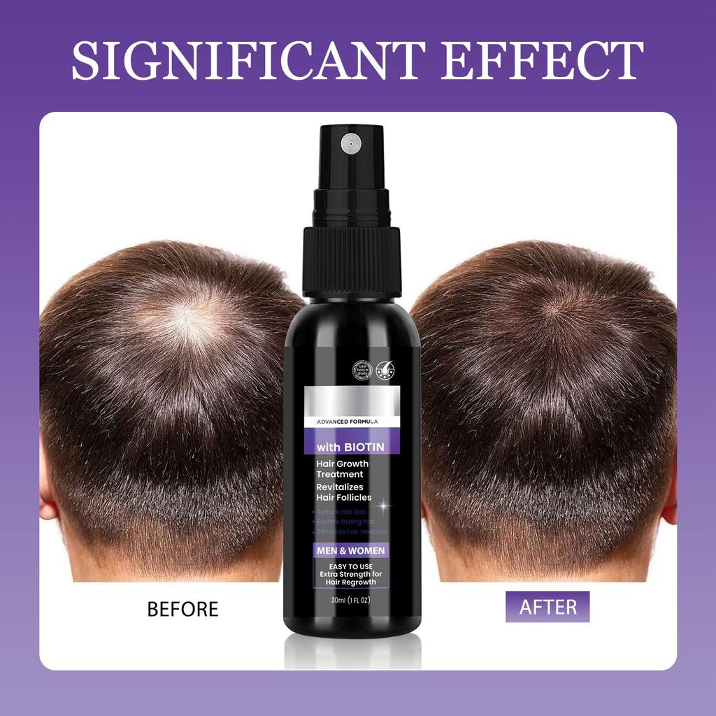 Hair Growth Nourishes Hair Follicles, Reduces Hair Loss, Scalp Care Biotin Dense Hair Spray,60ml