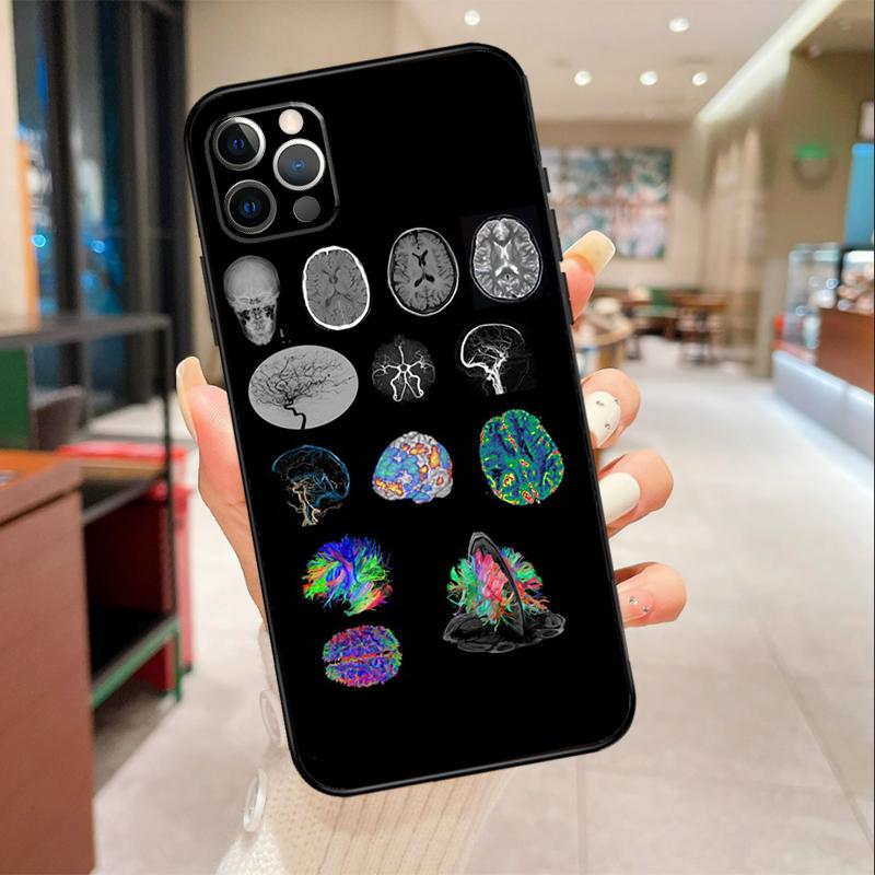 Medical Human Organs Brain Phone Case For iPhone 16 15 14 11 12 13 17 Pro Max mini 15 Plus 16e 17 Air Protective Cover