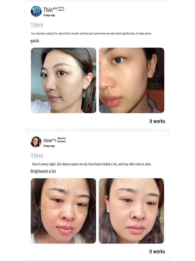 Han Bei Dan White Oil - Whitening & Freckle Removal Essence