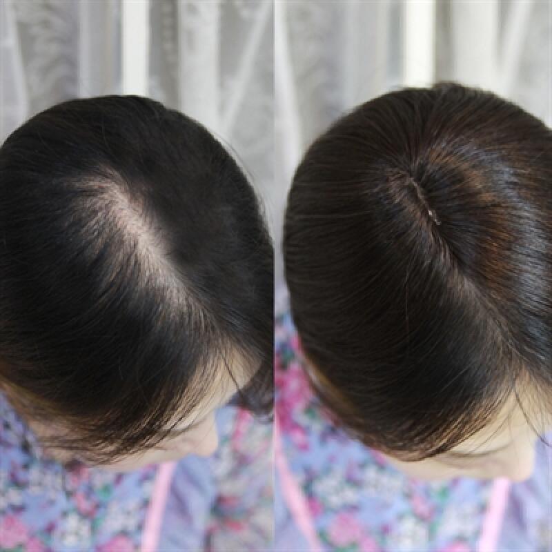 Crown Cover Wig (Parted/Volume Up Wig) Wedding Hair