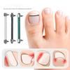 Narzędzie do Pedicure na Wrastające Paznokcie u Stóp Wkładka Pielęgnacja Paznokci u Stóp Prostowanie Korekcyjne Klips Zakrzywiony Zacisk Narzędzie do Korekcji Paznokci u Stóp