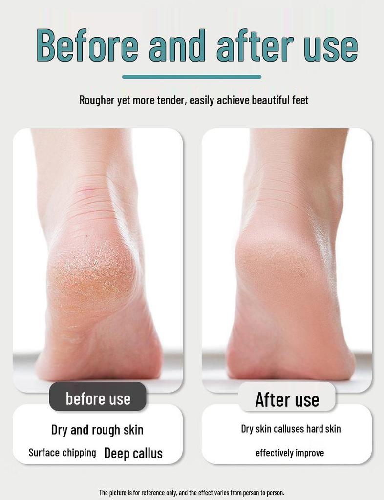 Rechargeable Electric Pedicure Callus Remover & Grinder Tool