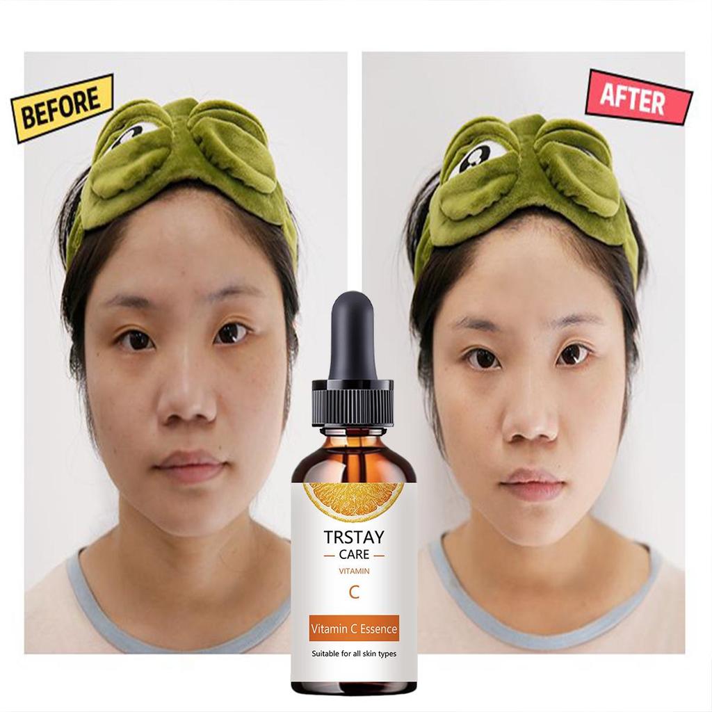 Bělicí esence pro péči o pleť obsahuje vitamín C, antioxidant, hydratační a zvlhčující esenci a vyživující pleťovou vodu.