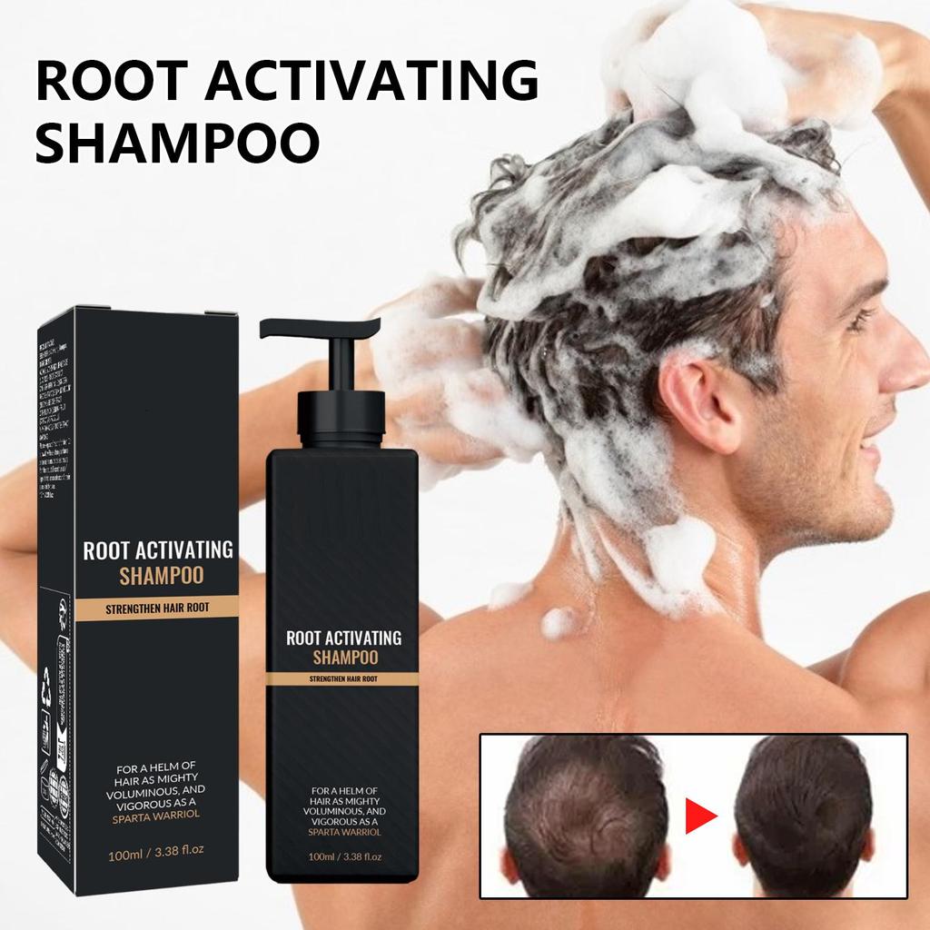 Hair Loss Treatment Shampoo Promotes Growth, Strengthens Roots, Repairs Scalp, Anti-Thinning