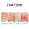 John Jeff - 20% Azelaic Acid Acne Treatment Gel