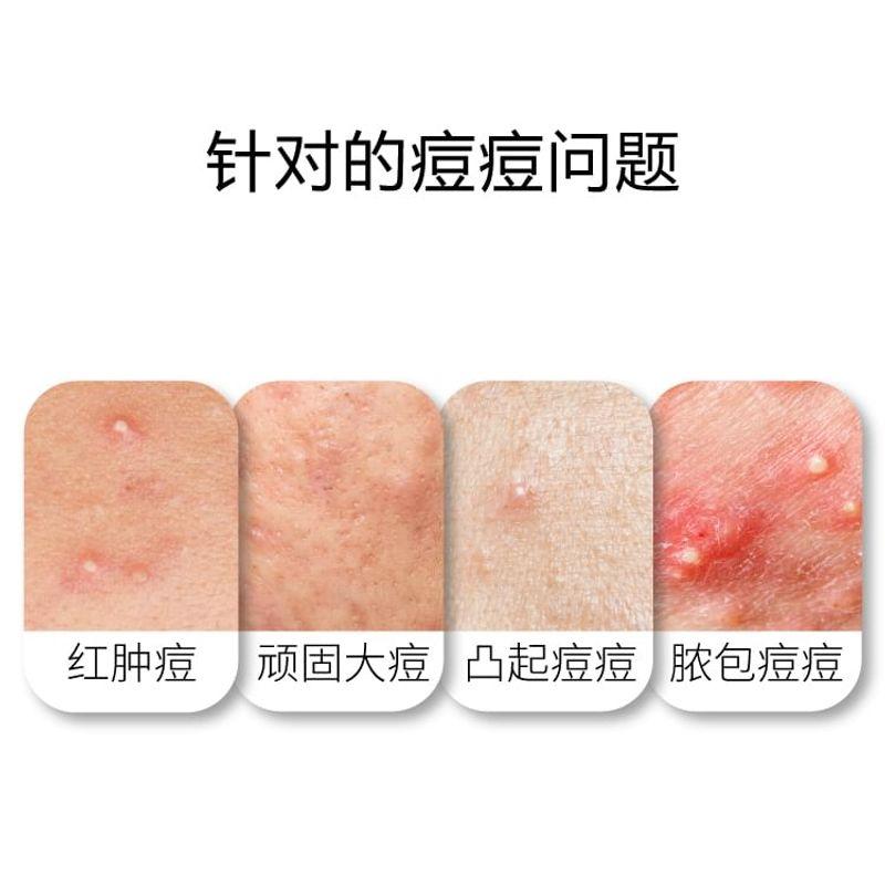 John Jeff - 20% Azelaic Acid Acne Treatment Gel