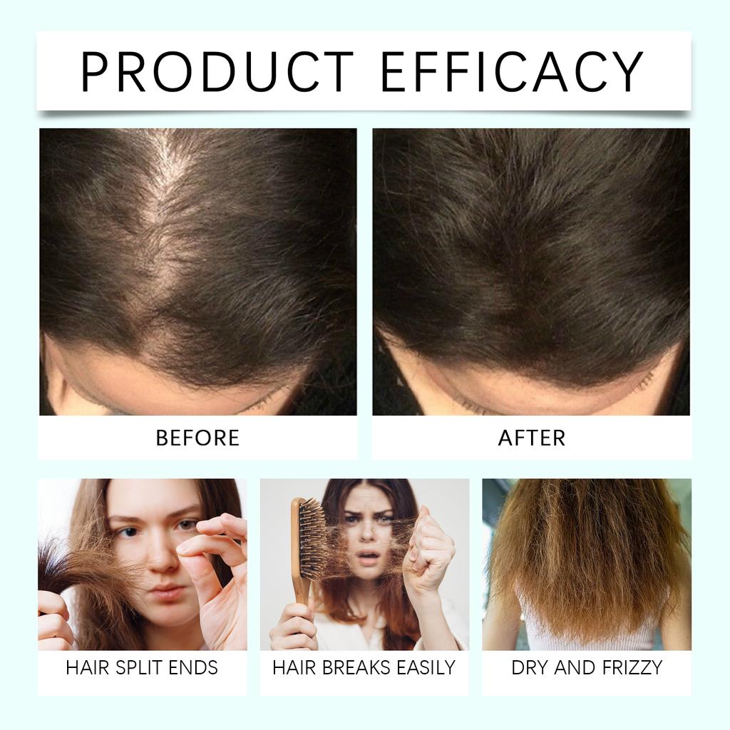 Herbal Hair Growth Spray Activates Hair Follicles To Prevent Hair Loss And Breakage. Add Rice Water And Aloe Vera60ML