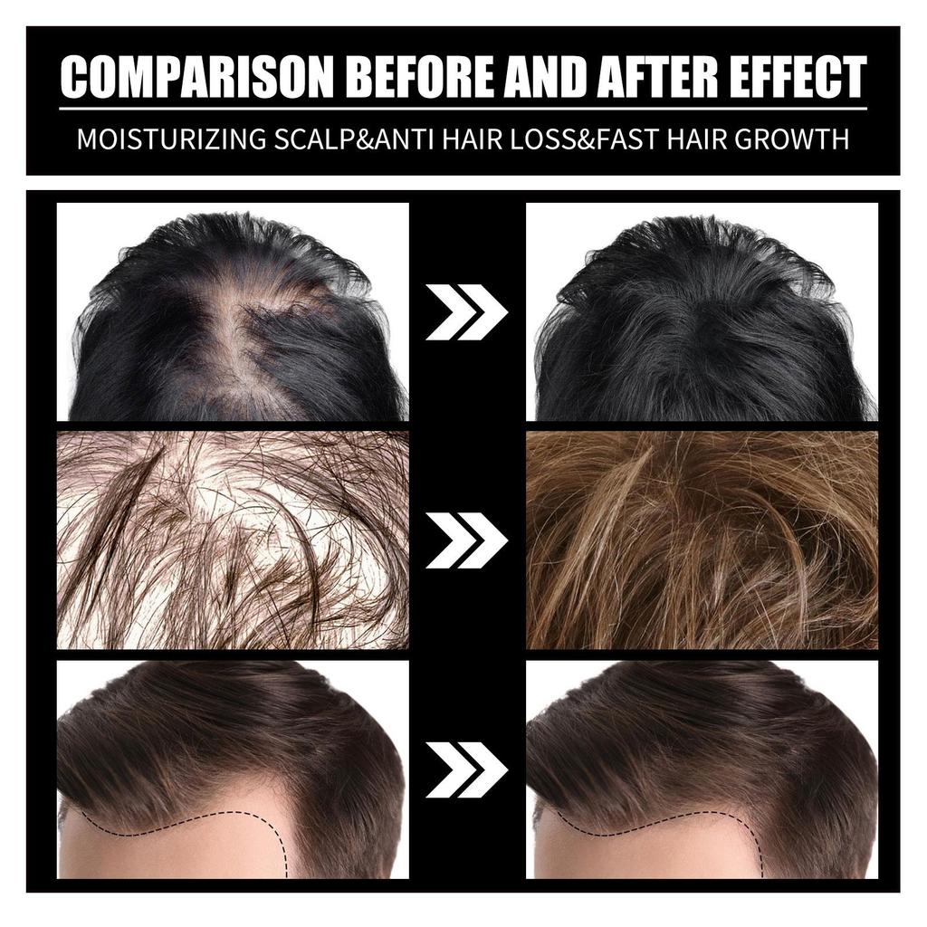 Collagen & Vitamin B7 Hair Oil, Nourishing & Gentle Hair Care, Softens & Smooths Hair