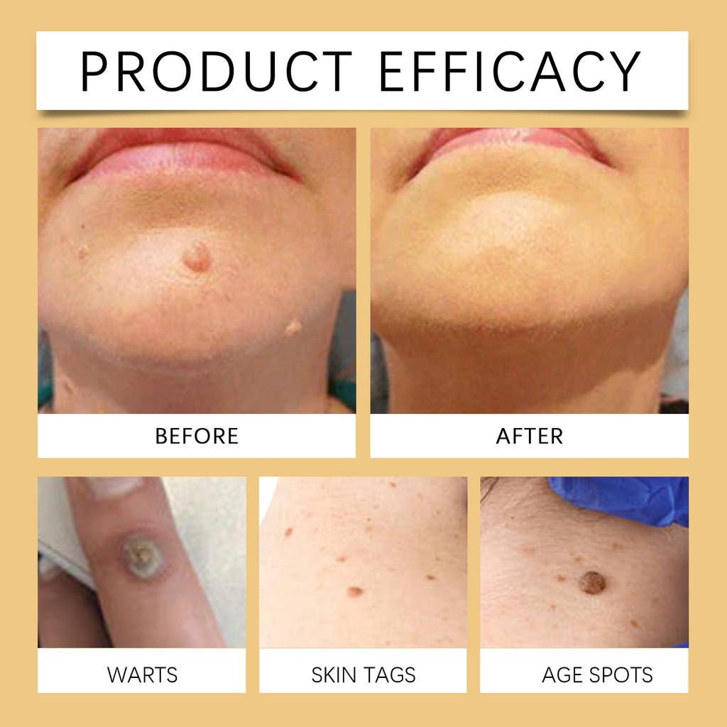 Wiyun Venom Bee Skin Care Cream Gentle Herbal Formula For Dark Spot Lightening 60g